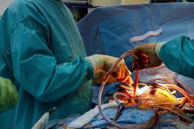 Cardiovascular and thoracic surgery department